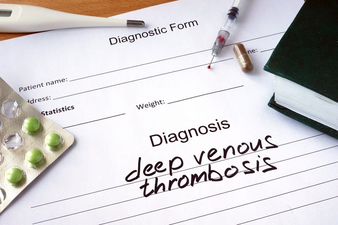 Receiving Social Security Disability for Deep Vein Thrombosis