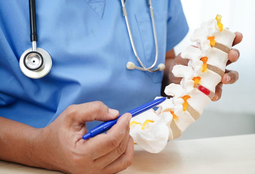 Receiving Social Security Disability for Spinal Stenosis