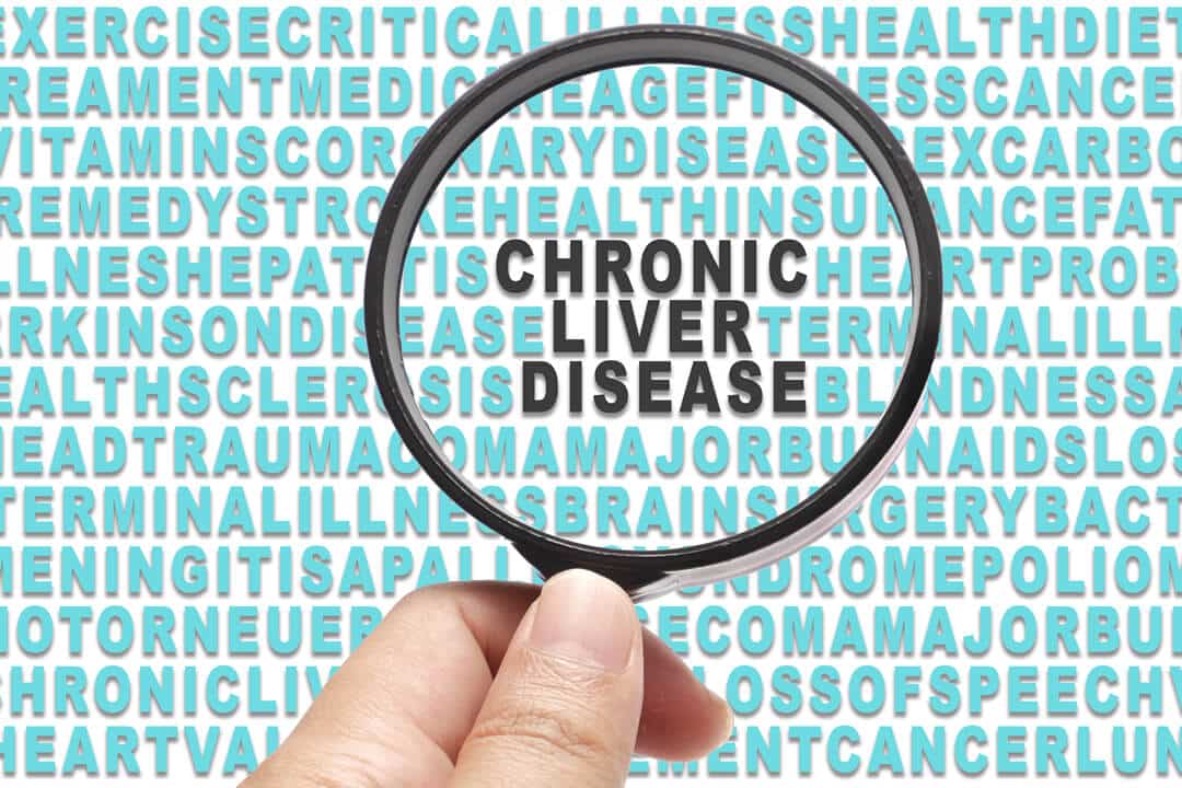Receiving Social Security Disability for Chronic Liver Disease