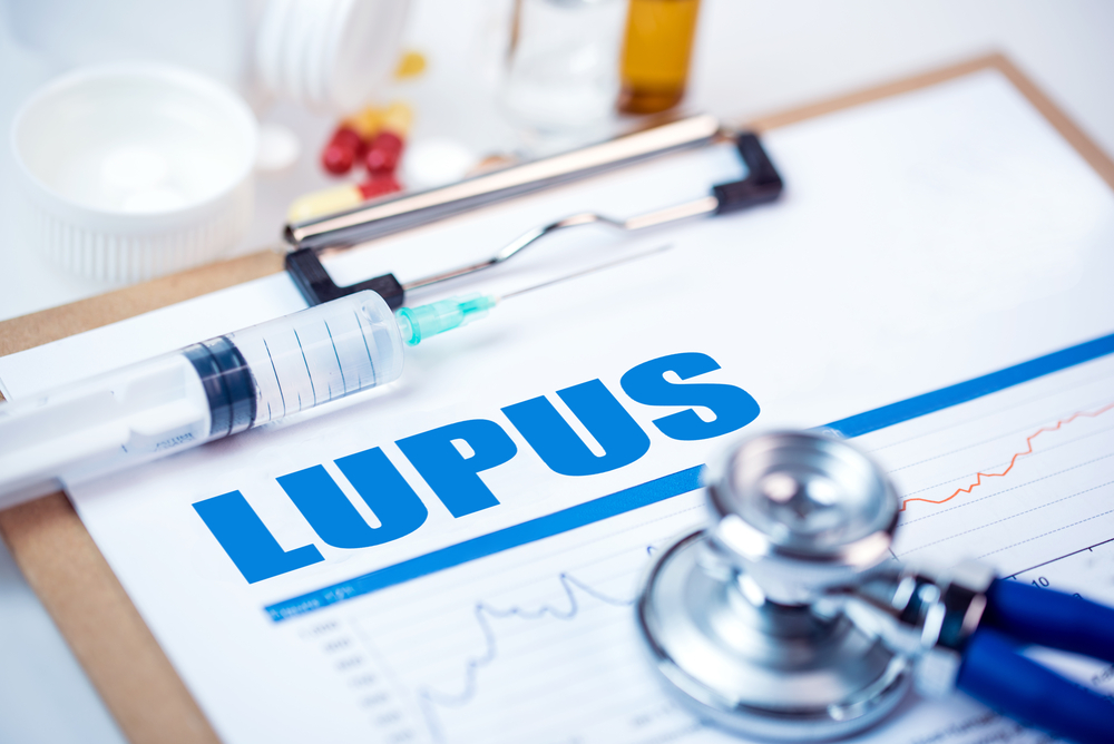 Receiving Social Security Benefits for Lupus