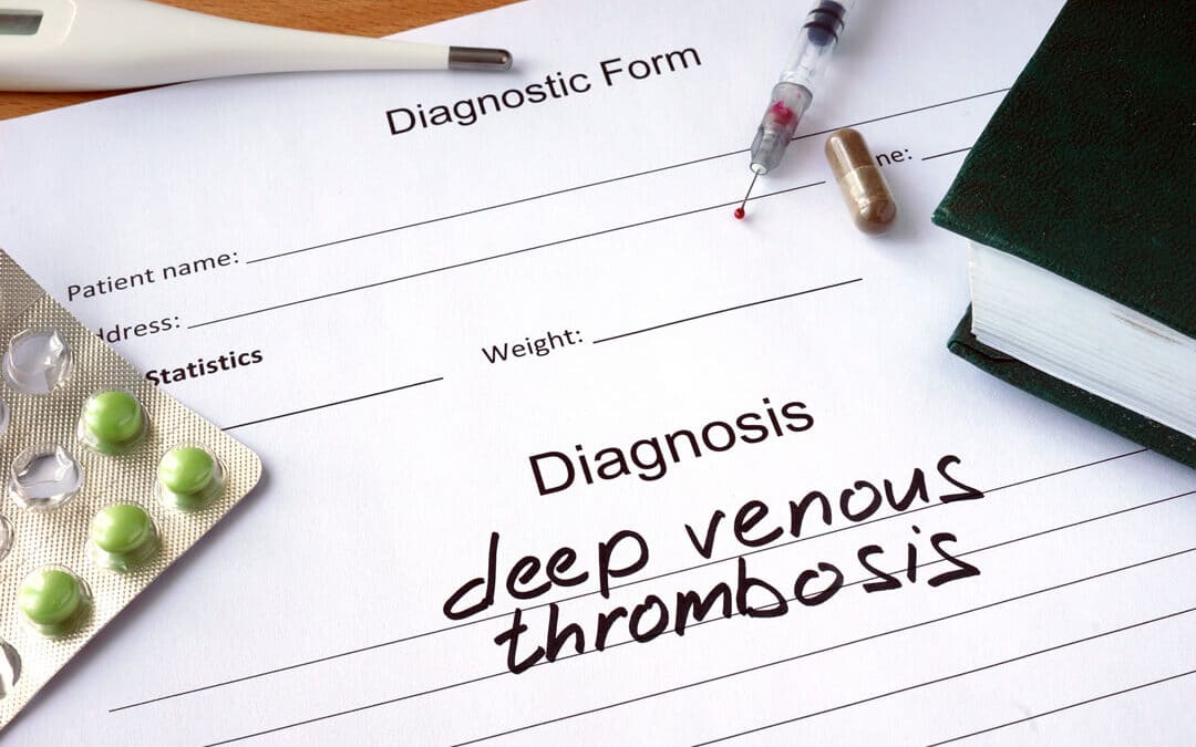 Receiving Social Security Disability for Deep Vein Thrombosis